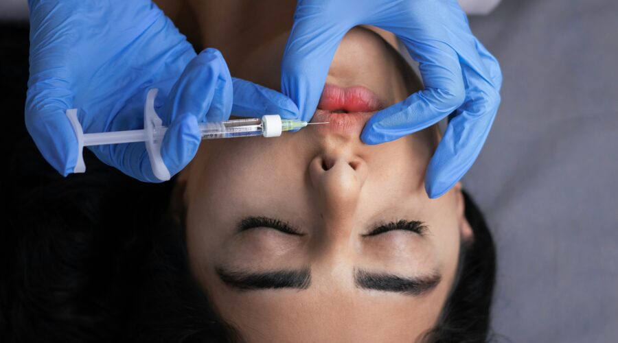 źle podany kwas hialuronowy w usta