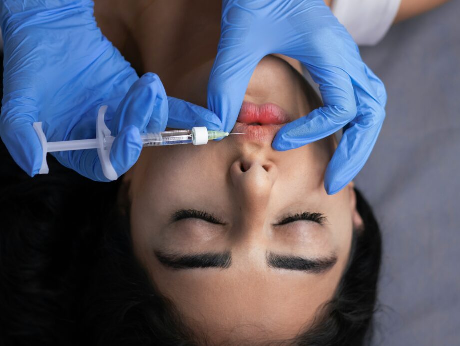 źle podany kwas hialuronowy w usta